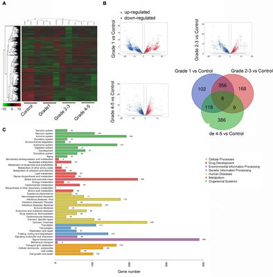 Circulating CircRNAs Panel Acts as a Biomarker for the Early Diagnosis and Severity of Parkinson’s Disease